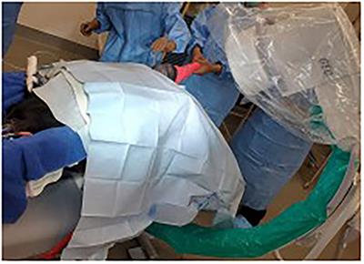 Case report: Fluoroscopic-assisted closed reduction and minimally invasive femoral capital physeal fracture repair in four calves